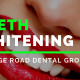 Teeth Whitening in Ipswich